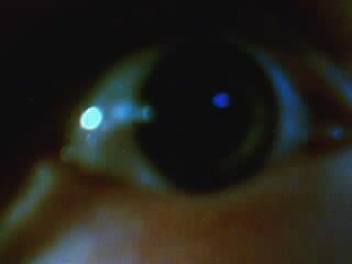 Eye.jpg